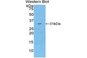 Image no. 1 for anti-Laminin, gamma 1 (LAMC1) (AA 1283-1551) antibody (ABIN1078268)
