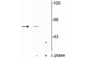 Image no. 2 for anti-Synaptotagmin I (SYT1) (pSer309) antibody (ABIN361497)