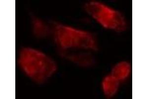Image no. 3 for anti-Polo-Like Kinase 3 (PLK3) antibody (ABIN6258103)