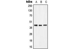 Image no. 2 for anti-Potassium Voltage-Gated Channel, Shaker-Related Subfamily, beta Member 3 (KCNAB3) (C-Term) antibody (ABIN2704941)