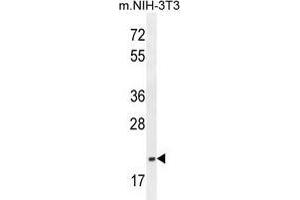 Image no. 1 for anti-Transcription Elongation Factor A (SII)-Like 3 (TCEAL3) (AA 22-52), (N-Term) antibody (ABIN955123)