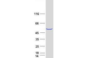 Image no. 1 for Methyltransferase Like 18 (METTL18) protein (Myc-DYKDDDDK Tag) (ABIN2714008)