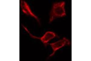 Image no. 1 for anti-Collagen, Type IV, alpha 2 (COL4A2) (N-Term) antibody (ABIN6258413)
