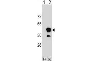 Image no. 1 for anti-CD1b (CD1B) (AA 57-85) antibody (ABIN3030367)