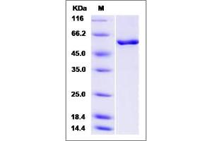 Image no. 1 for Calcium/calmodulin-Dependent Protein Kinase IV (CAMK4) (AA 1-469) protein (ABIN3216431)