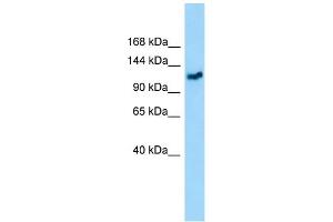 Image no. 2 for anti-GEM Interacting Protein (GMIP) (C-Term) antibody (ABIN2790252)