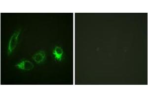 Immunofluorescence analysis of HeLa cells, using IRS-1 (Phospho-Ser323) Antibody.