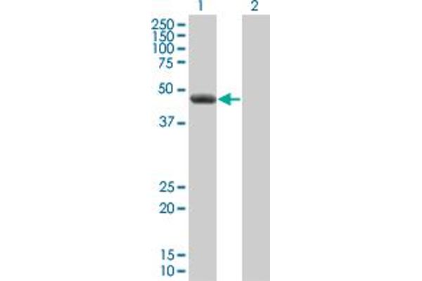 anti-Cleavage and Polyadenylation Factor I Subunit 1 (CLP1) (AA 316-425) antibody