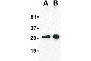 Image no. 2 for anti-Mitochondrial Antiviral Signaling Protein (MAVS) (Internal Region) antibody (ABIN6657099)