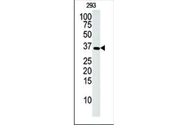 Deoxyguanosine Kinase antibody  (N-Term)