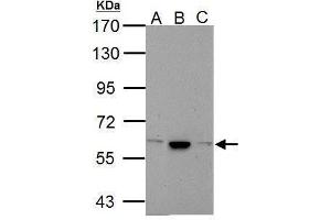 Image no. 4 for anti-Calcium Channel, Voltage-Dependent, beta 4 Subunit (CACNB4) (C-Term) antibody (ABIN2854649)
