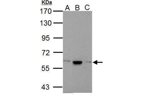 CACNB4 antibody  (C-Term)