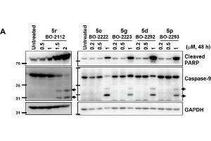 Image no. 117 for anti-Glyceraldehyde-3-Phosphate Dehydrogenase (GAPDH) (Center) antibody (ABIN2857072)