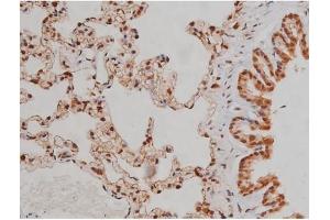 Image no. 8 for anti-Insulin-Like Growth Factor 1 Receptor (IGF1R) (pTyr1346) antibody (ABIN6256637)