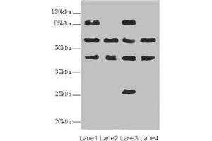 FLVCR2 antibody  (AA 1-100)