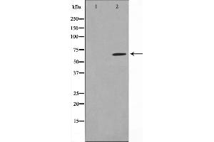 Image no. 2 for anti-Protein Inhibitor of Activated STAT, 1 (PIAS1) (N-Term) antibody (ABIN6264195)