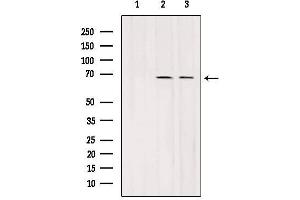 Image no. 2 for anti-Solute Carrier Family 7 (Cationic Amino Acid Transporter, Y+ System), Member 3 (SLC7A3) antibody (ABIN6265148)