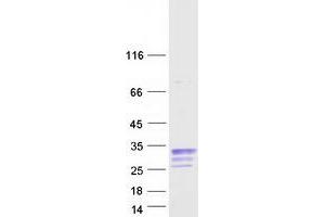Image no. 1 for Cerebellin 1 Precursor (CBLN1) protein (Myc-DYKDDDDK Tag) (ABIN2713925)