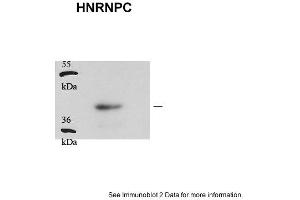 Image no. 1 for anti-Heterogeneous Nuclear Ribonucleoprotein C (C1/C2) (HNRNPC) (Middle Region) antibody (ABIN2778890)