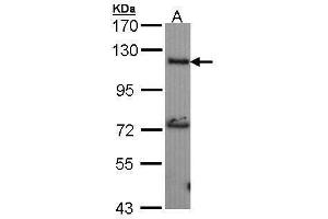 Image no. 1 for anti-Adenylate Cyclase 2 (Brain) (ADCY2) (Internal Region) antibody (ABIN2855022)
