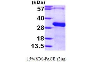 Image no. 1 for Regulator of G-Protein Signalling 19 (RGS19) (AA 1-217) protein (His tag) (ABIN667286)