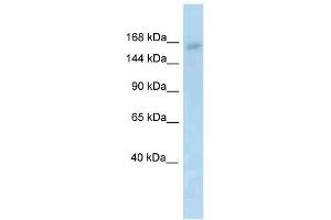 Image no. 1 for anti-Lysine (K)-Specific Demethylase 6A (KDM6A) (N-Term) antibody (ABIN927446)