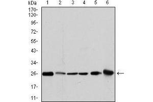 Image no. 4 for anti-Glutathione S-Transferase mu 1 (GSTM1) antibody (ABIN969181)