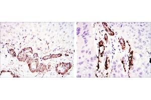 Image no. 2 for anti-Actin, alpha 2, Smooth Muscle, Aorta (ACTA2) antibody (ABIN968946)