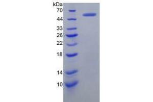 Image no. 2 for Protein L-Myc (MYCL) (AA 184-454) (Active) protein (His tag,GST tag) (ABIN6239821)