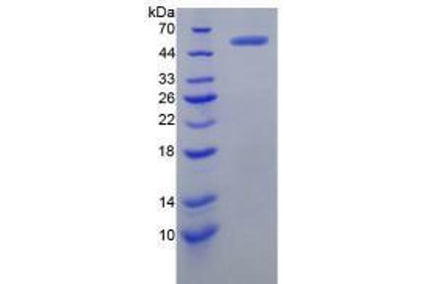 LMYC Protein (AA 184-454) (His tag,GST tag)