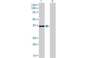 Image no. 5 for anti-Paired-Like Homeodomain 1 (PITX1) (AA 225-313) antibody (ABIN562248)
