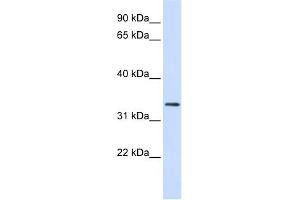 Image no. 2 for anti-F-Box Protein 25 (FBXO25) (N-Term) antibody (ABIN2774695)