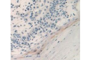 Image no. 2 for anti-Prostate Stem Cell Antigen (PSCA) (AA 22-95) antibody (ABIN1860333)