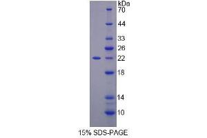 Image no. 1 for Spermine Oxidase (SMOX) (AA 1-165) protein (His tag) (ABIN6236923)