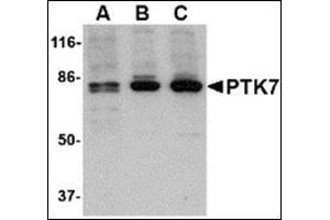 Image no. 1 for anti-PTK7 Protein tyrosine Kinase 7 (PTK7) (N-Term) antibody (ABIN500555)