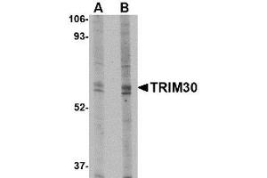 TRIM30 抗体  (N-Term)