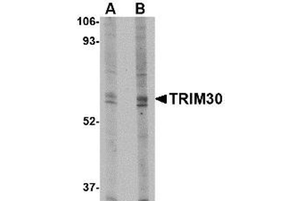 TRIM30 抗体  (N-Term)