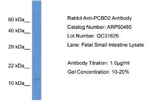 Image no. 1 for anti-Pterin-4 alpha-Carbinolamine Dehydratase/dimerization Cofactor of Hepatocyte Nuclear Factor 1 alpha (TCF1) 2 (PCBD2) (N-Term) antibody (ABIN2788466)