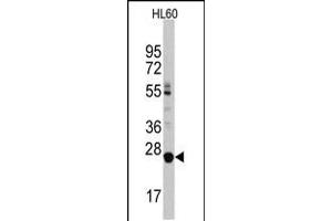 Image no. 1 for anti-Lin-28 Homolog B (LIN28B) (AA 218-250), (C-Term) antibody (ABIN5536363)