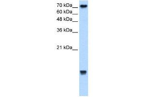 Image no. 1 for anti-Ubiquitin-Conjugating Enzyme E2N (UBE2N) (Middle Region) antibody (ABIN2777765)