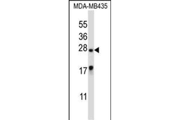 MEA1 抗体  (N-Term)