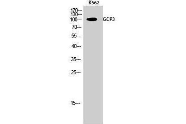 anti-Folate Hydrolase 1B (FOLH1B) (Internal Region) antibody