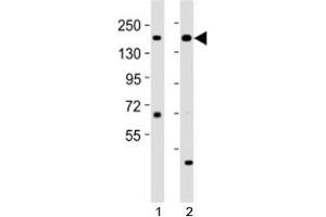 Western blot testing of Kdm6a antibody at 1:2000 dilution.
