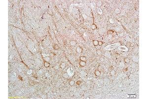 Immunohistochemistry (Paraffin-embedded Sections) (IHC (p)) image for anti-Nitric Oxide Synthase 1, Neuronal (NOS1) (AA 51-150) antibody (ABIN725585)