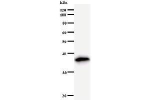 Image no. 1 for anti-Neuroepithelial Cell Transforming 1 (NET1) antibody (ABIN931061)