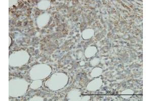 Image no. 2 for anti-Protein C Receptor, Endothelial (PROCR) (AA 1-239) antibody (ABIN599144)