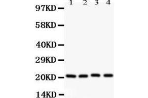 Image no. 4 for anti-Caveolin 1, Caveolae Protein, 22kDa (CAV1) (AA 4-178) antibody (ABIN3043803)