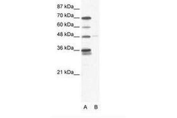 anti-GLIS Family Zinc Finger 2 (GLIS2) (AA 83-132) antibody