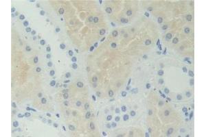 Image no. 2 for anti-Adenosylhomocysteinase (AHCY) (AA 2-432) antibody (ABIN1866592)