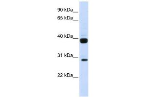 Image no. 1 for anti-Fms-Related tyrosine Kinase 3 Ligand (FLT3LG) (N-Term) antibody (ABIN635754)